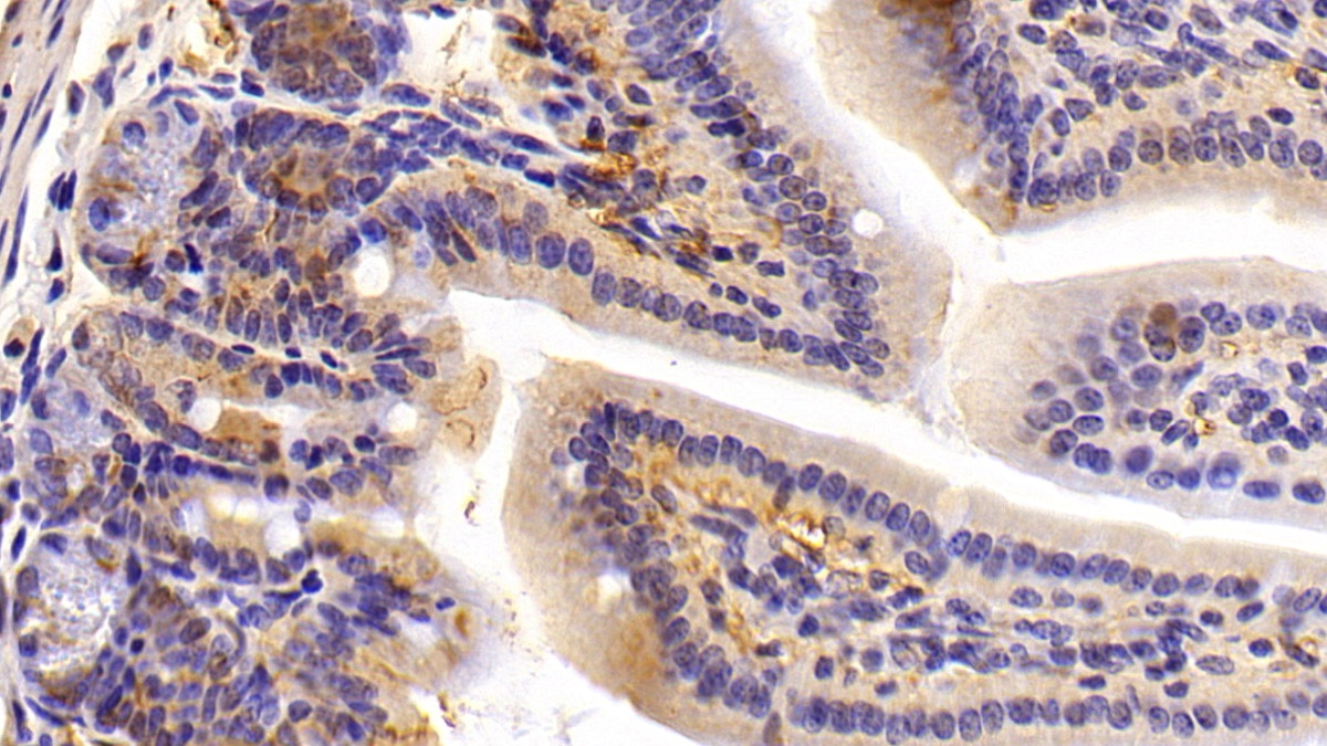 Polyclonal Antibody to Sex Hormone Binding Globulin (SHBG)