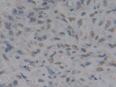 Polyclonal Antibody to High Mobility Group Protein 1 (HMGB1)