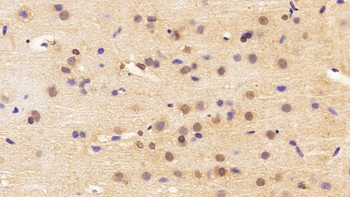 Polyclonal Antibody to High Mobility Group Protein 1 (HMGB1)