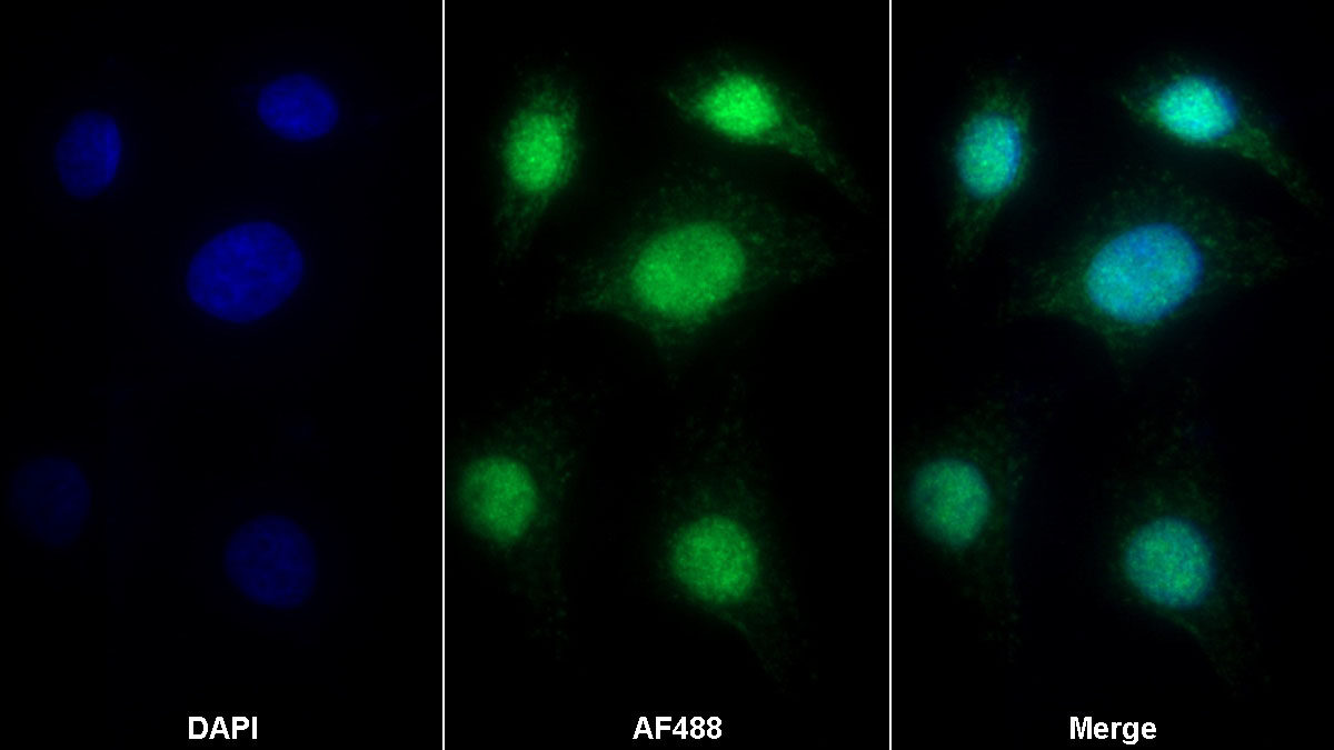 Polyclonal Antibody to High Mobility Group Protein 1 (HMGB1)