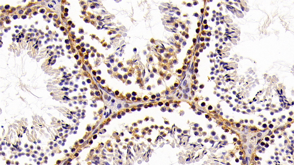 Polyclonal Antibody to High Mobility Group Protein 1 (HMGB1)