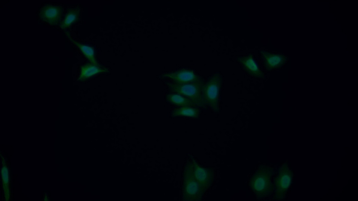 Polyclonal Antibody to High Mobility Group Protein 1 (HMGB1)