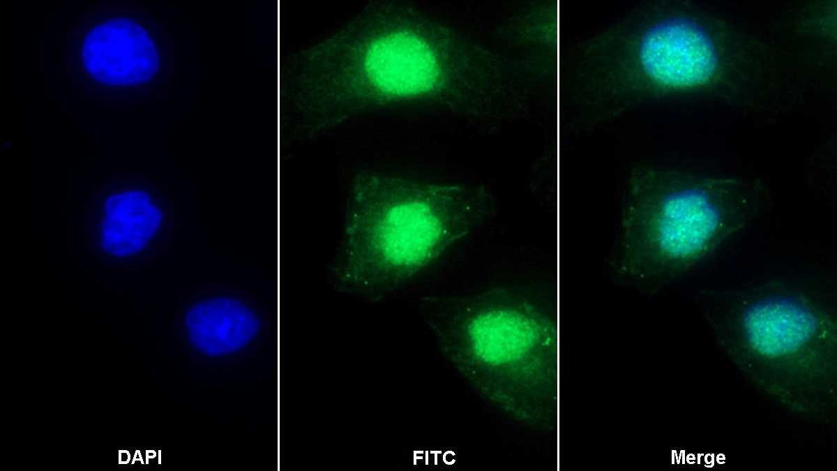 Polyclonal Antibody to High Mobility Group Protein 1 (HMGB1)