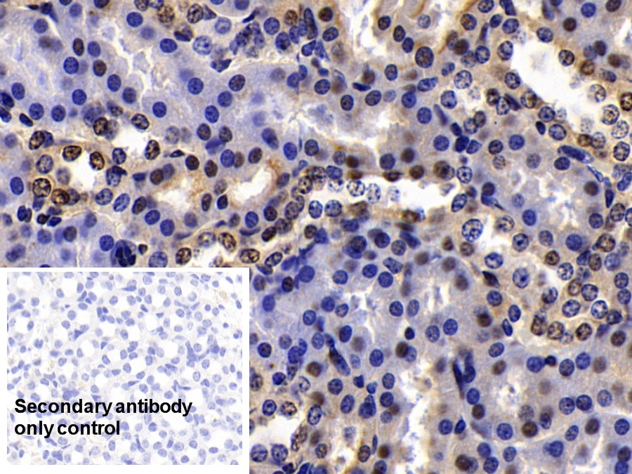 Polyclonal Antibody to High Mobility Group Protein 1 (HMGB1)