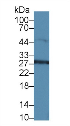 Polyclonal Antibody to High Mobility Group Protein 1 (HMGB1)