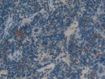 Polyclonal Antibody to High Mobility Group Protein 1 (HMGB1)