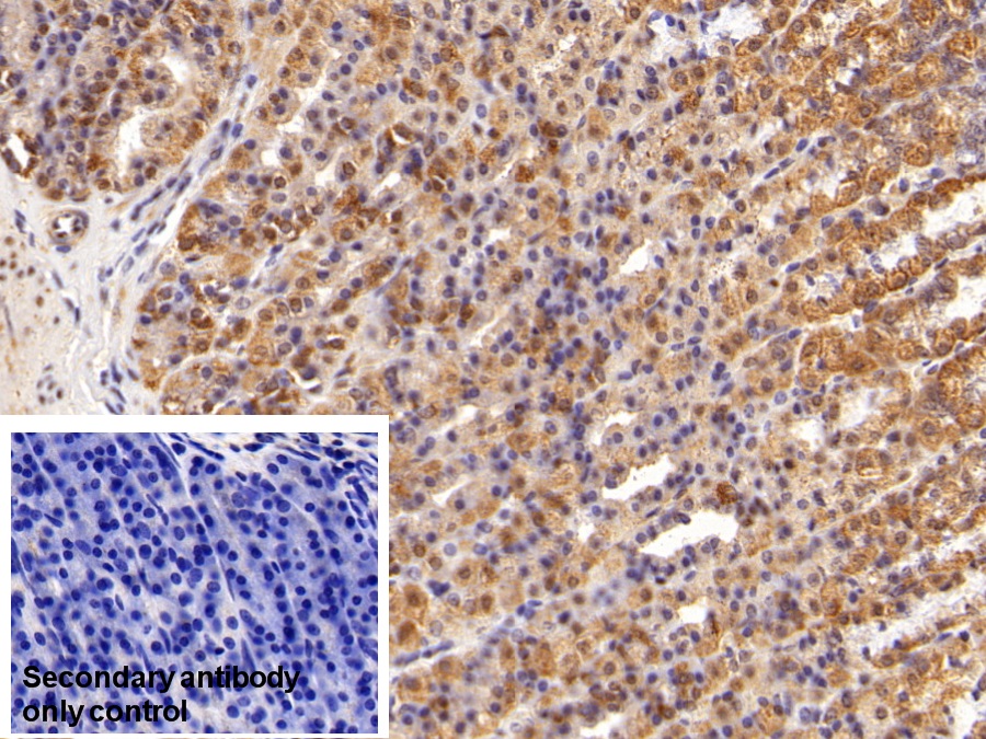 Polyclonal Antibody to High Mobility Group Protein 1 (HMGB1)