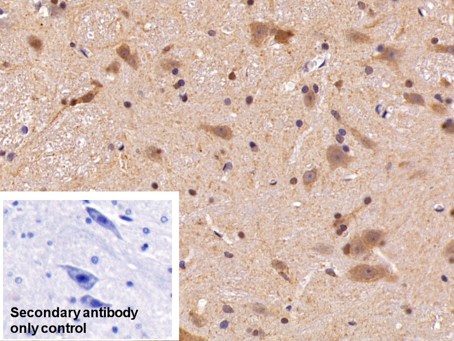 Polyclonal Antibody to High Mobility Group Protein 1 (HMGB1)