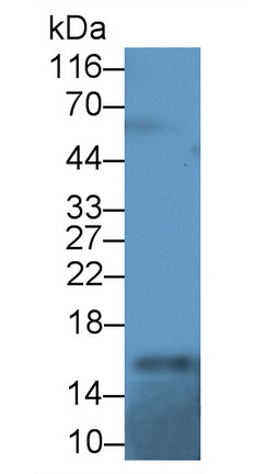 Polyclonal Antibody to Retinol Binding Protein 1, Cellular (RBP1)