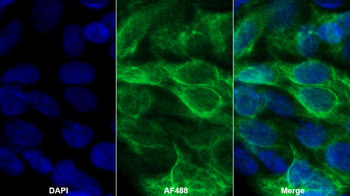 Polyclonal Antibody to Matrix Metalloproteinase 12 (MMP12)