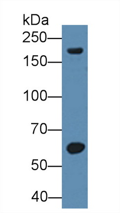 Polyclonal Antibody to Matrix Metalloproteinase 12 (MMP12)