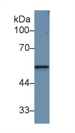 Polyclonal Antibody to Matrix Metalloproteinase 12 (MMP12)