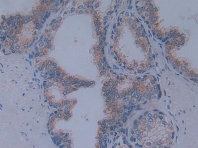 Polyclonal Antibody to Cadherin, Retinal (RCAD)