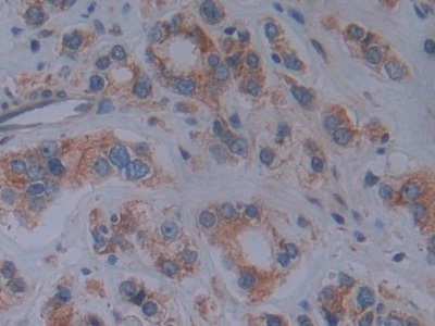 Polyclonal Antibody to Cadherin, Retinal (RCAD)