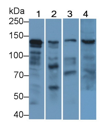 Polyclonal Antibody to Cadherin, Retinal (RCAD)