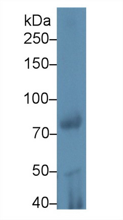 Polyclonal Antibody to Phospholipase A2, Calcium Independent (iPLA2)