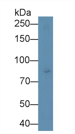 Polyclonal Antibody to Phospholipase A2, Calcium Independent (iPLA2)