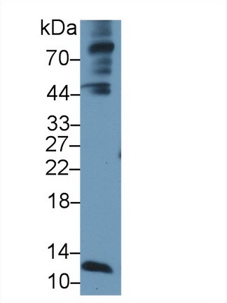 Polyclonal Antibody to Alpha-Hemoglobin Stabilizing Protein (aHSP)