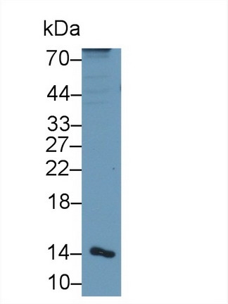 Polyclonal Antibody to Alpha-Hemoglobin Stabilizing Protein (aHSP)