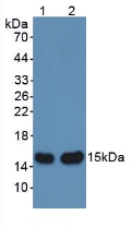 Polyclonal Antibody to Alpha-Hemoglobin Stabilizing Protein (aHSP)