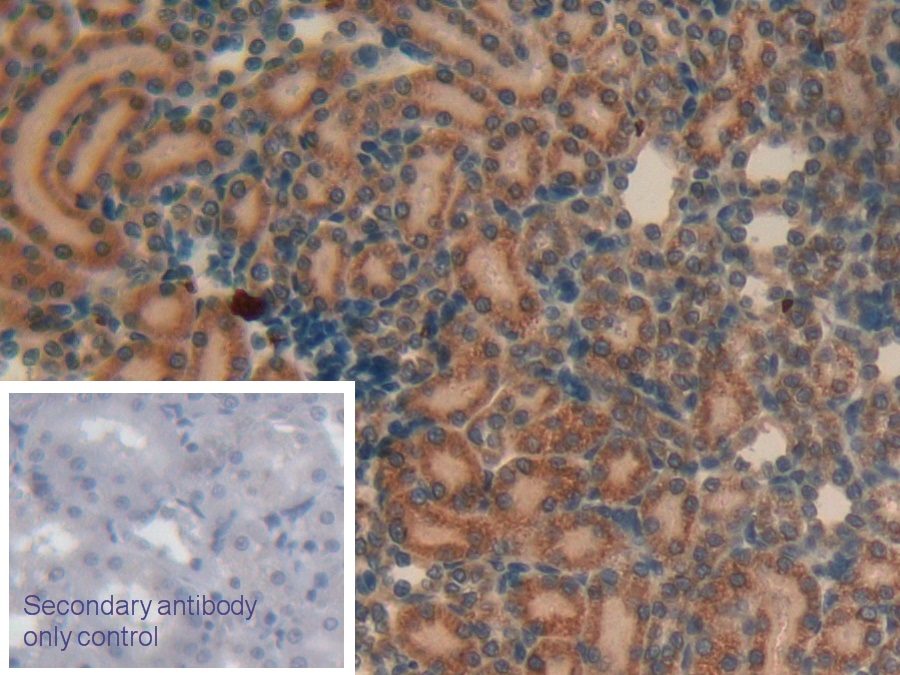 Polyclonal Antibody to Alpha-Hemoglobin Stabilizing Protein (aHSP)