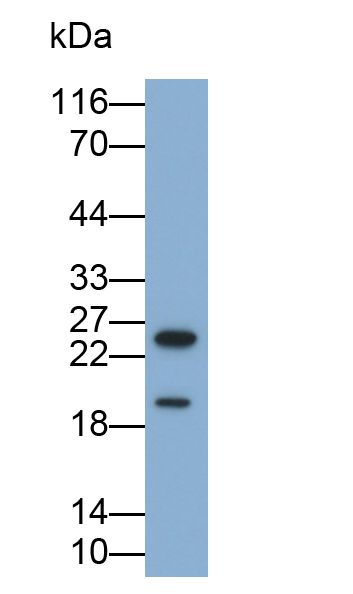 Polyclonal Antibody to Mucin 1 (MUC1)