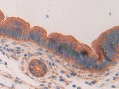 Polyclonal Antibody to Mucin 1 (MUC1)