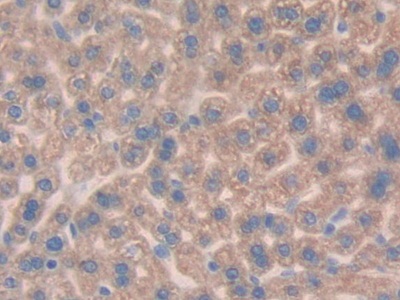 Polyclonal Antibody to Mucin 1 (MUC1)