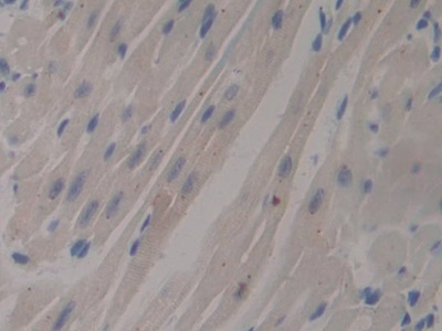 Polyclonal Antibody to Mucin 1 (MUC1)