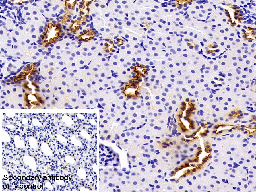 Polyclonal Antibody to Mucin 1 (MUC1)