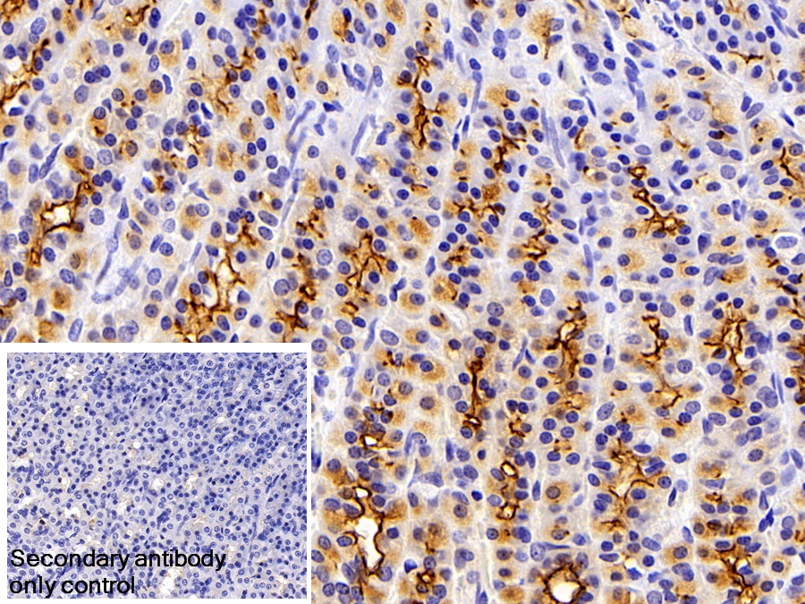 Polyclonal Antibody to Mucin 1 (MUC1)