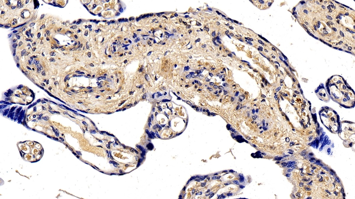 Polyclonal Antibody to Elastin Microfibril Interface Located Protein 1 (EMILIN1)