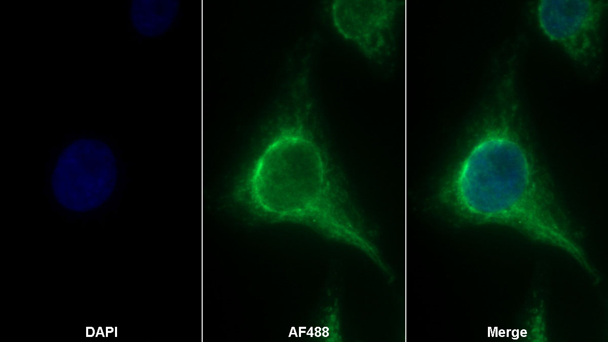 Polyclonal Antibody to Elastin Microfibril Interface Located Protein 1 (EMILIN1)