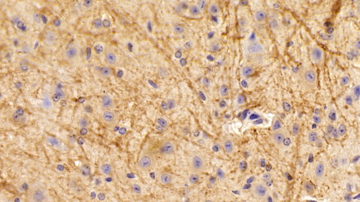 Polyclonal Antibody to Myelin Oligodendrocyte Glycoprotein (MOG)