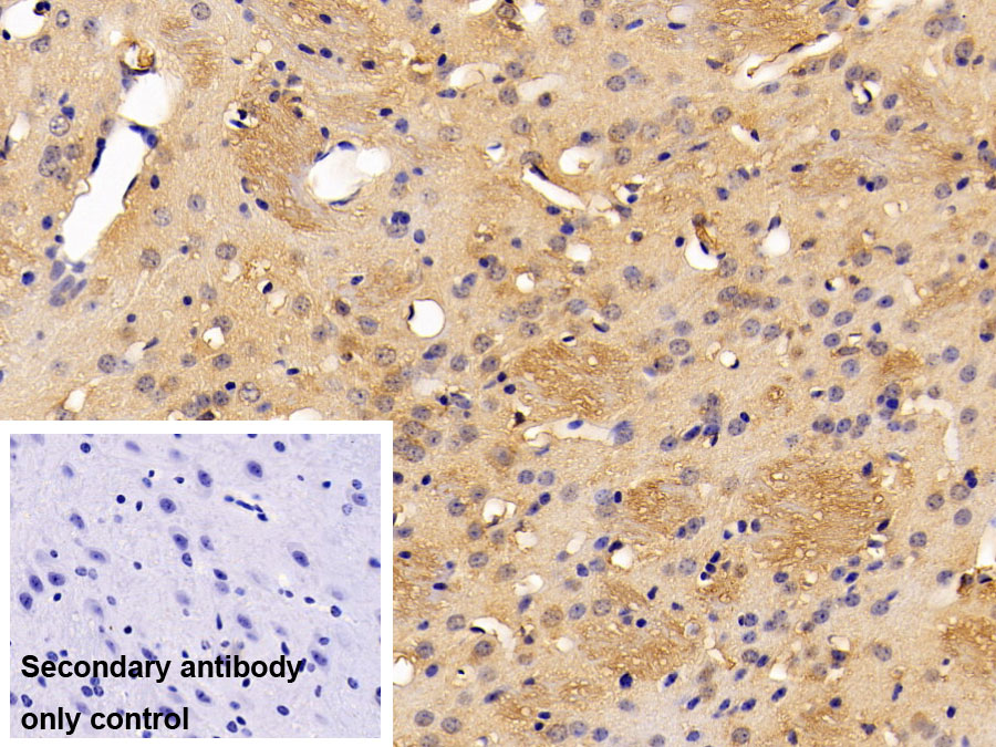 Polyclonal Antibody to Neurokinin A (NKA)