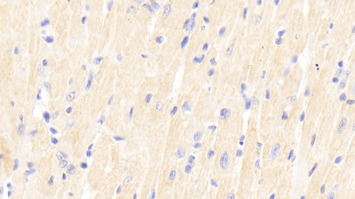 Polyclonal Antibody to Sirtuin 2 (SIRT2)