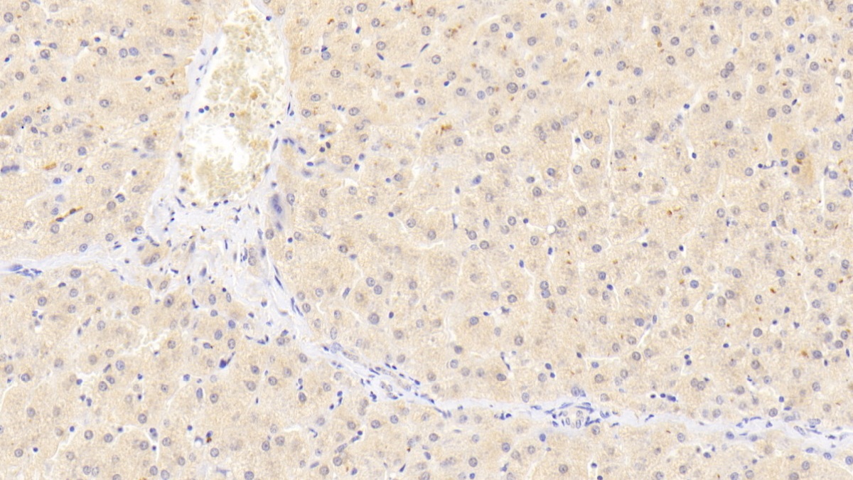 Polyclonal Antibody to Protein Kinase C Delta (PKCd)