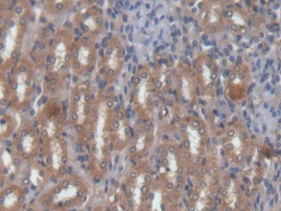 Polyclonal Antibody to Protein Kinase C Delta (PKCd)