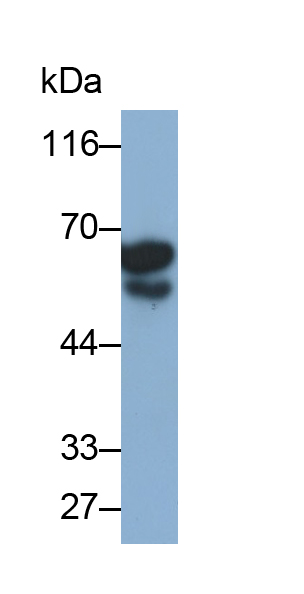 Polyclonal Antibody to Estrogen Receptor Beta (ERb)