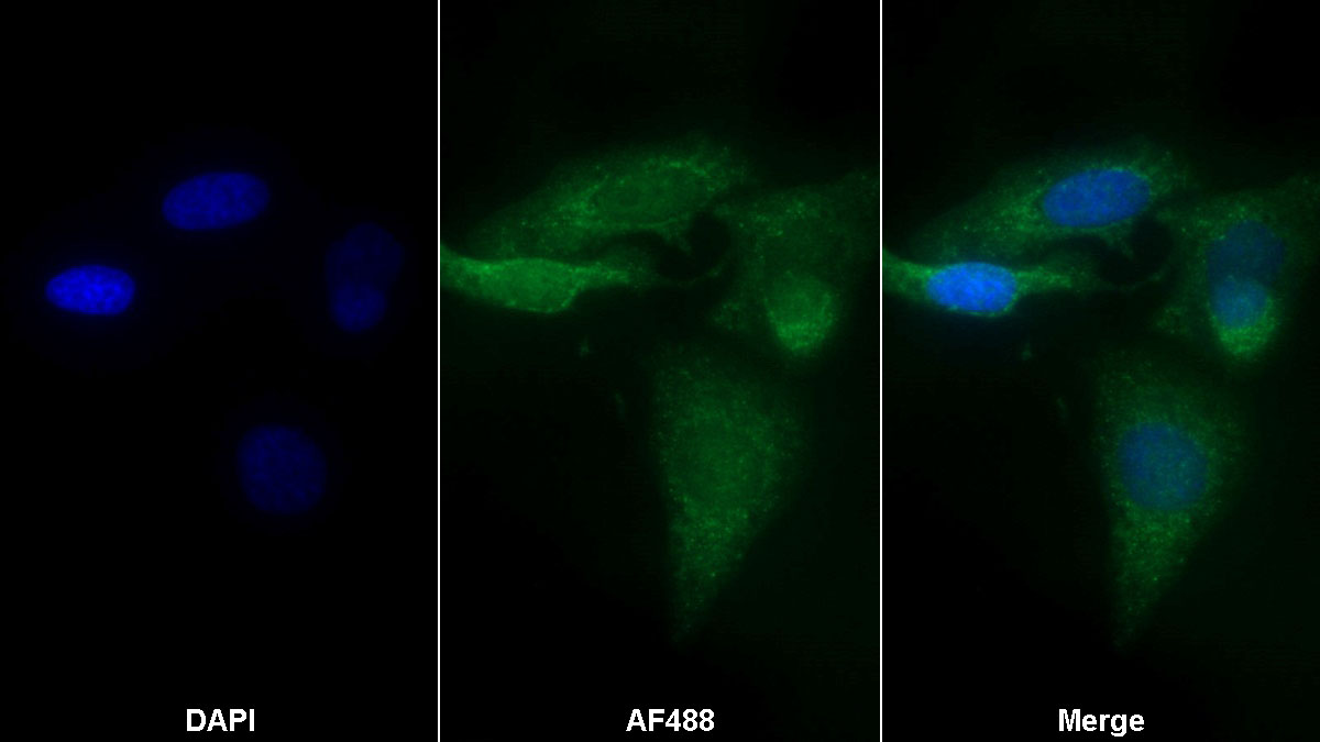 Polyclonal Antibody to Protein Kinase C Epsilon (PKCe)