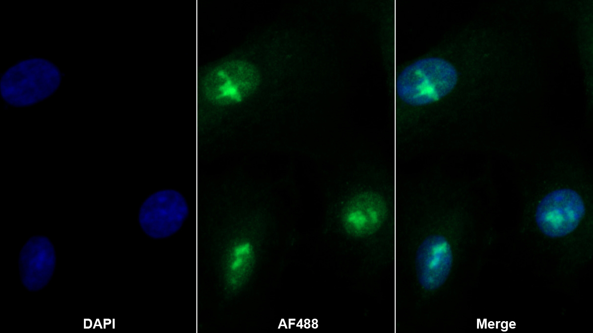 Polyclonal Antibody to Apoptosis Antagonizing Transcription Factor (AATF)