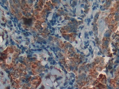 Polyclonal Antibody to Prohibitin (PHB)