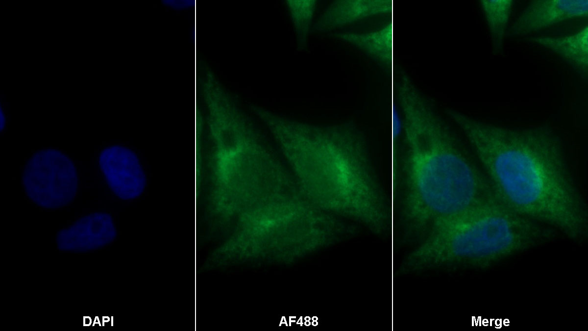 Polyclonal Antibody to Prohibitin (PHB)