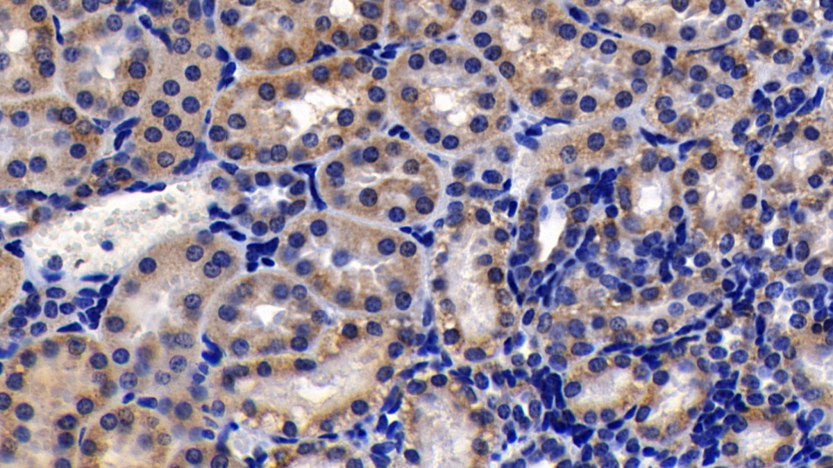 Polyclonal Antibody to Prohibitin (PHB)