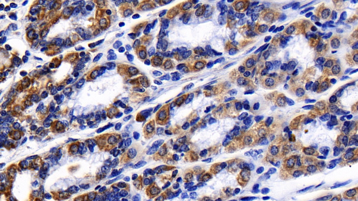 Polyclonal Antibody to Prohibitin (PHB)