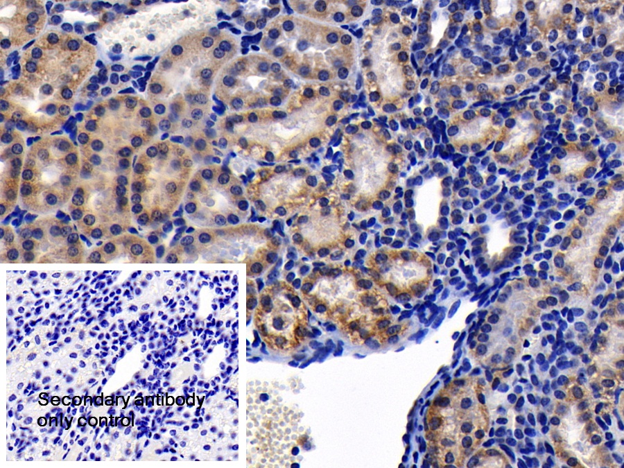 Polyclonal Antibody to Prohibitin (PHB)