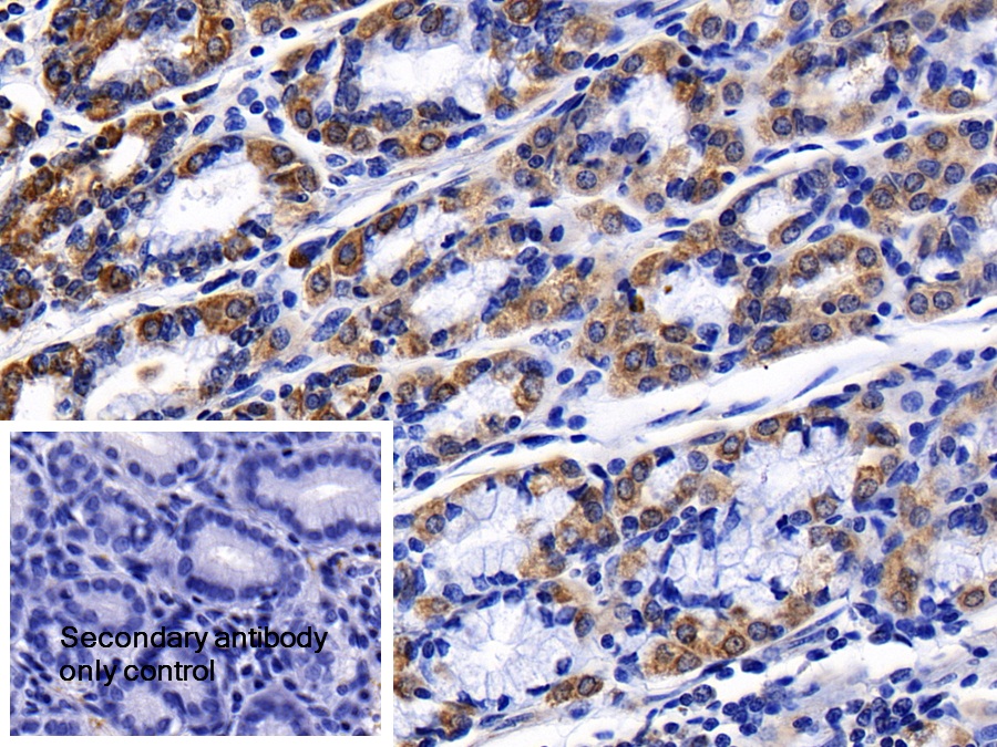 Polyclonal Antibody to Prohibitin (PHB)