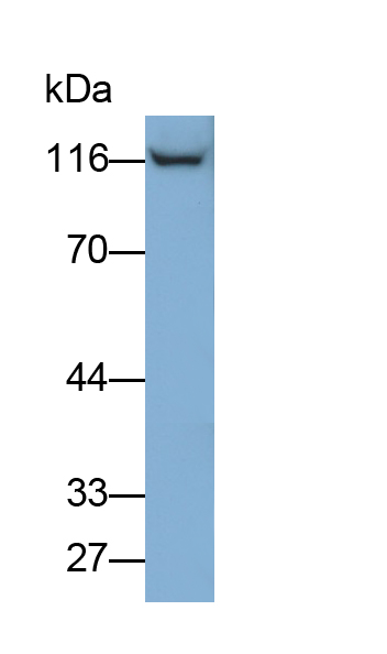 Polyclonal Antibody to Desmoglein 3 (DSG3)