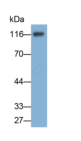 Polyclonal Antibody to Desmoglein 3 (DSG3)