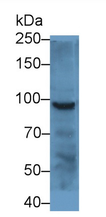 Polyclonal Antibody to Plakophilin 2 (PKP2)